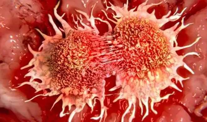 Common Cancer Symptoms and Signs: जांघ, गले, पैर या पीठ में दिखे ऐसा गाठ तो इस बिल्कुल हल्के में न ले, हो सकता है कैंसर - India TV Hindi News