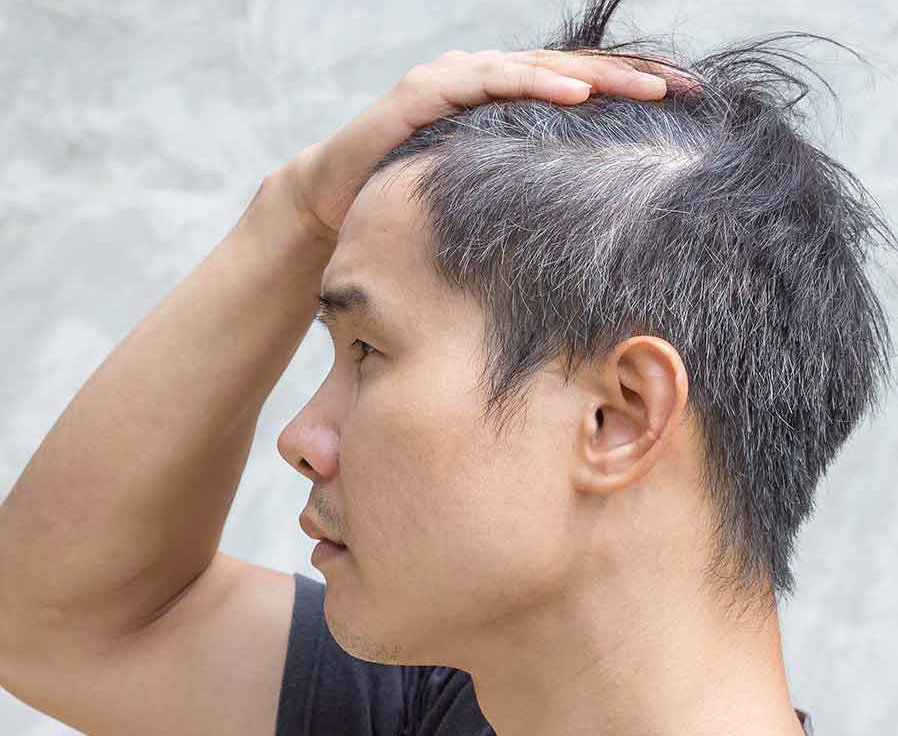 12 Surprising Signs Your Hair Will Go Gray - स्वास्थय और सेहत से जुड़े वे 12 लक्षण जो ग्रे बाल होने का इशारा करते हैं | Patrika News